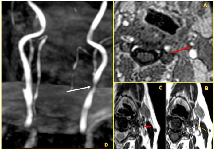 Figure 9