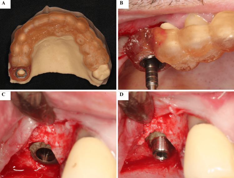 Figure 6