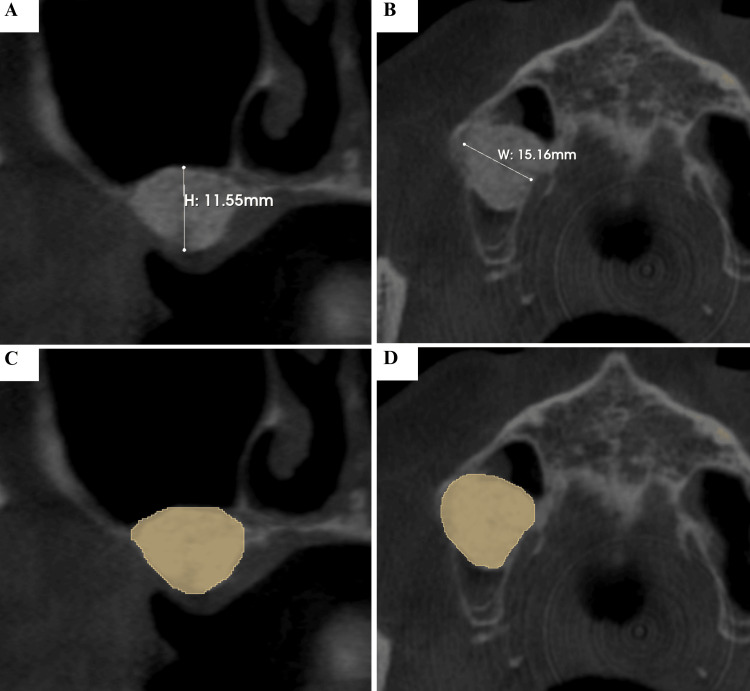 Figure 10