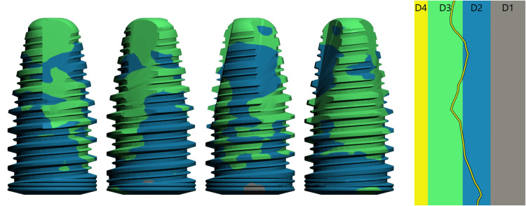 Figure 11