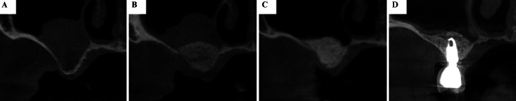 Figure 12