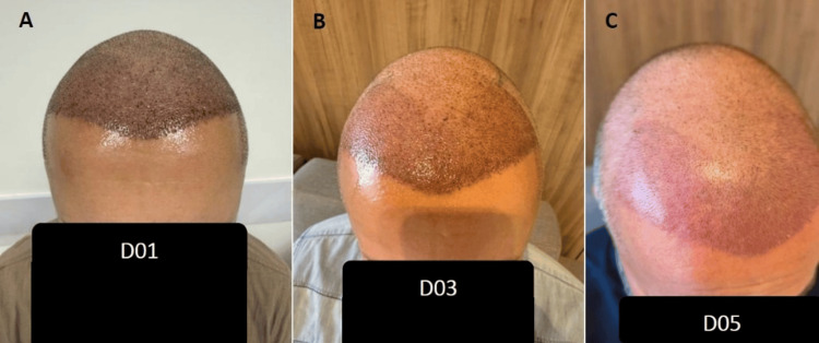 Figure 5