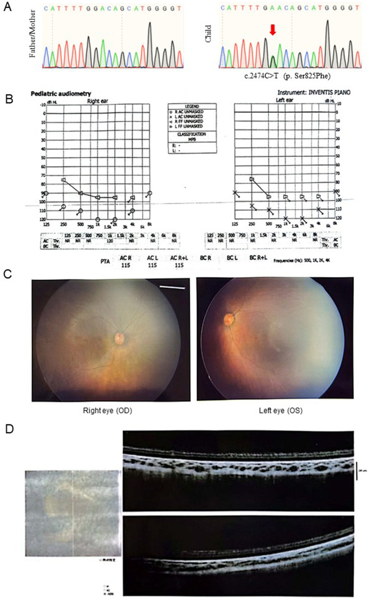 FIGURE 1