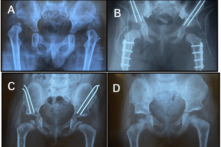 Figure 4