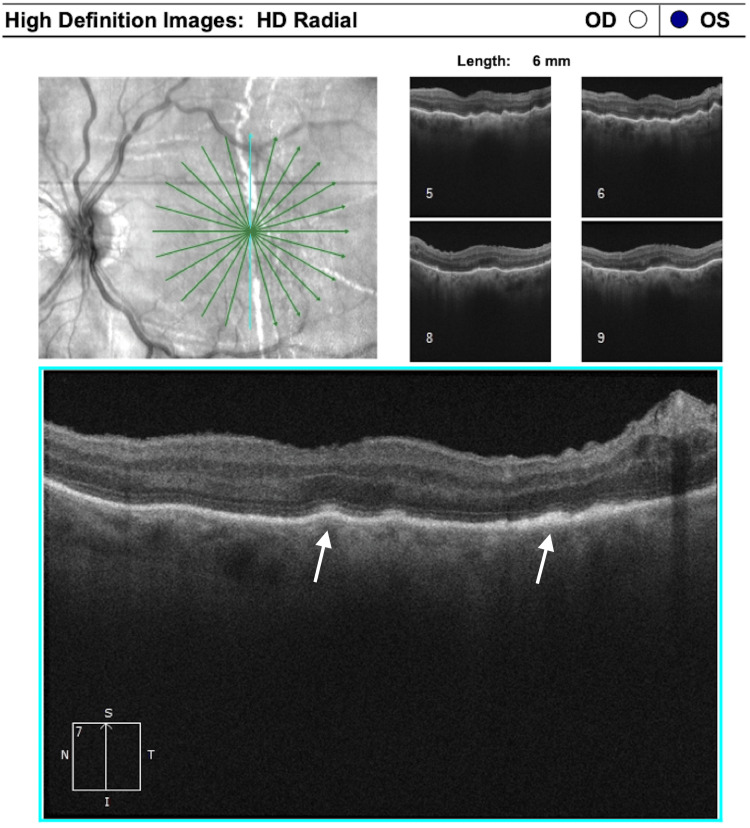 Figure 6