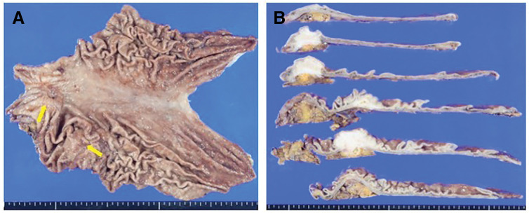 Fig. 6