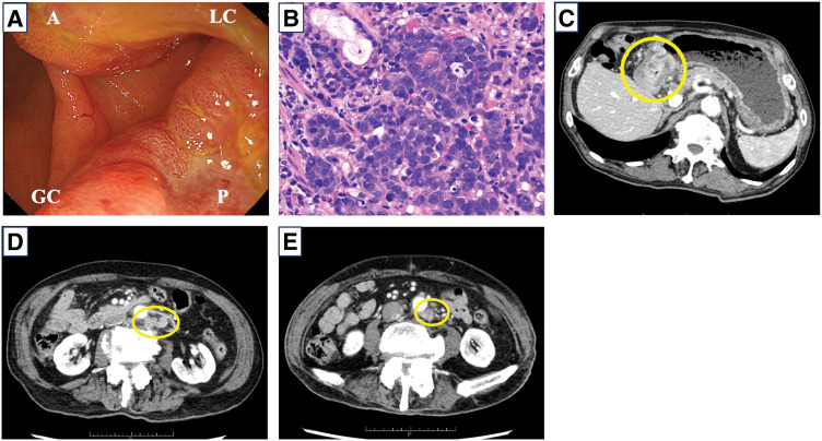 Fig. 1