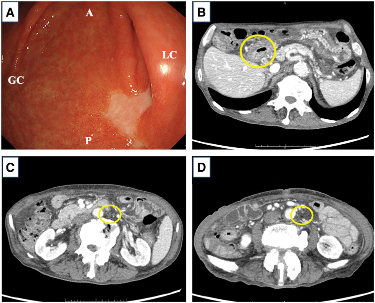 Fig. 2