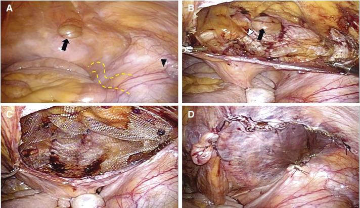 Fig. 4