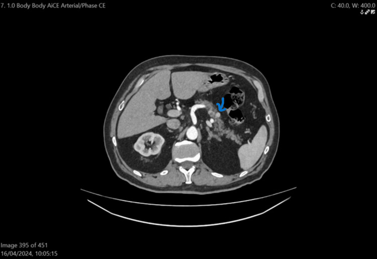Figure 5