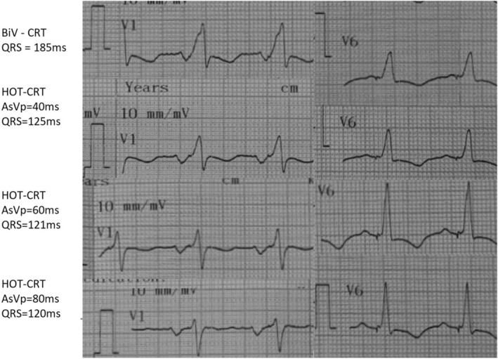 FIGURE 2
