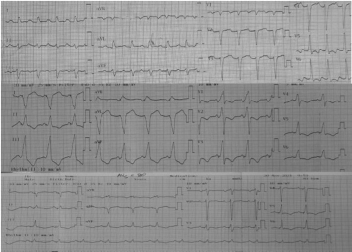 FIGURE 1
