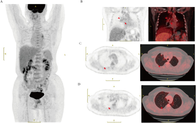 Figure 3
