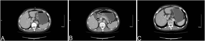Figure 1