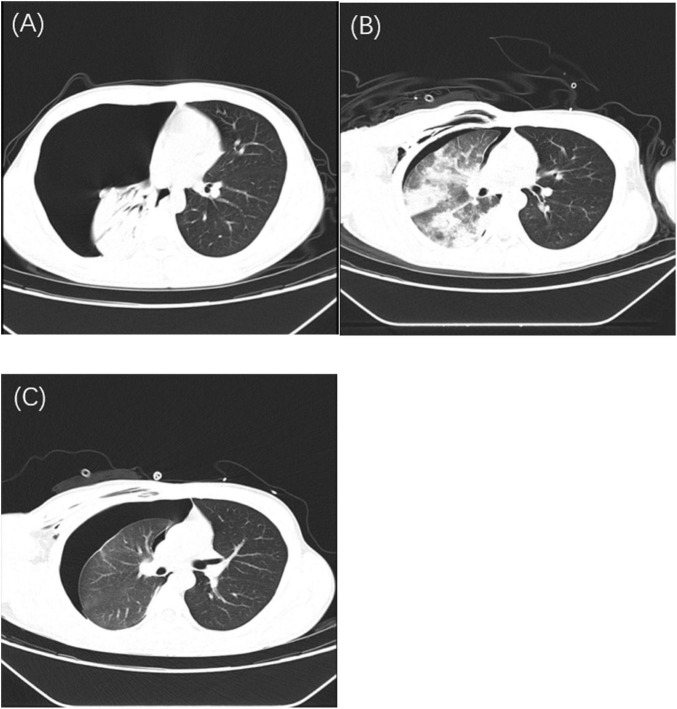 FIGURE 1