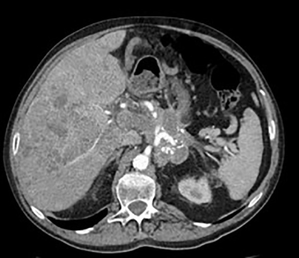 Figure 1
