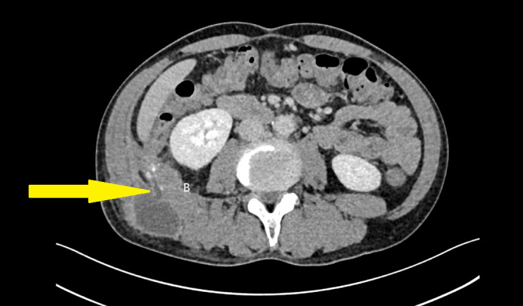 Figure 2