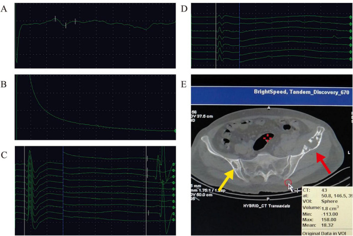 FIGURE 2