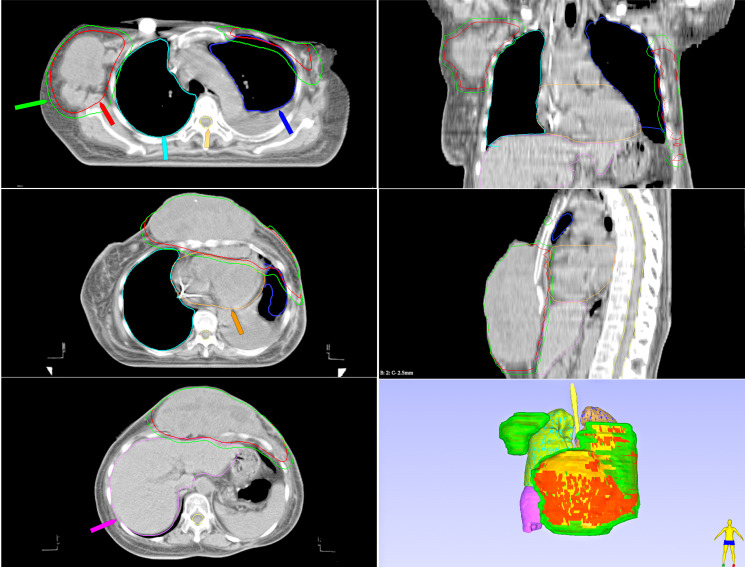 Figure 3