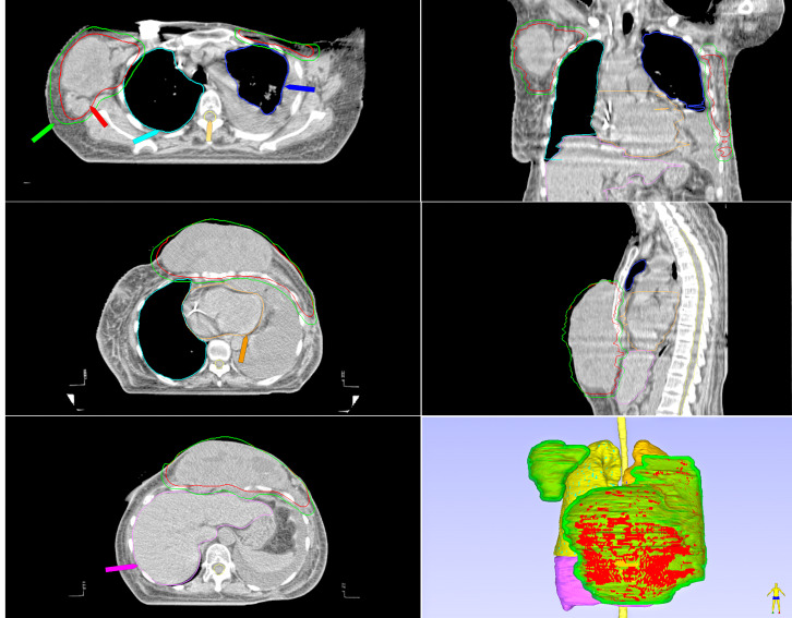 Figure 4