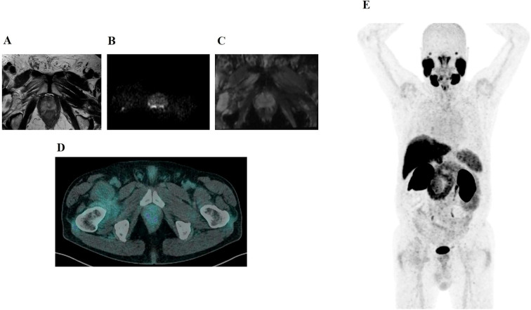 Figure 2