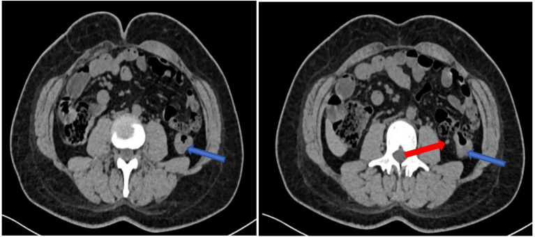 Figure 3