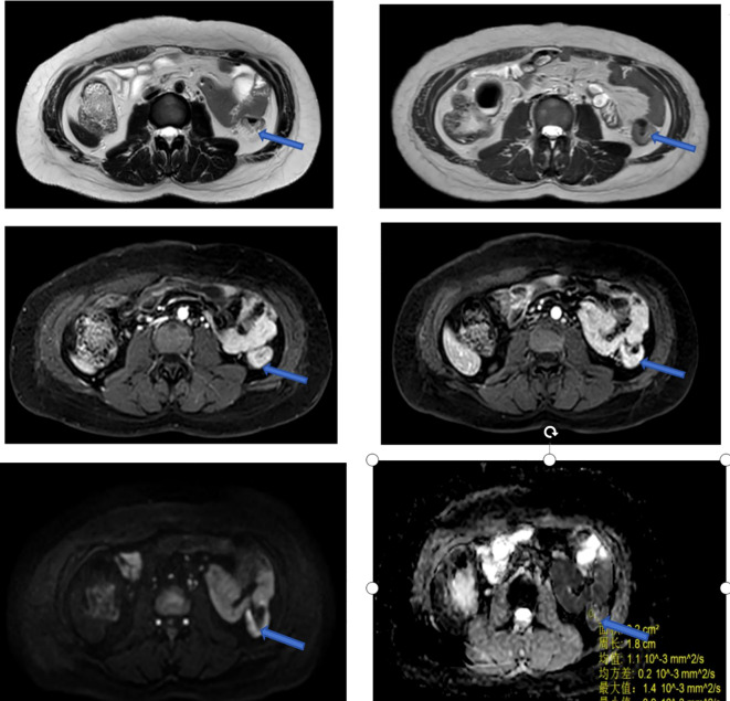Figure 4