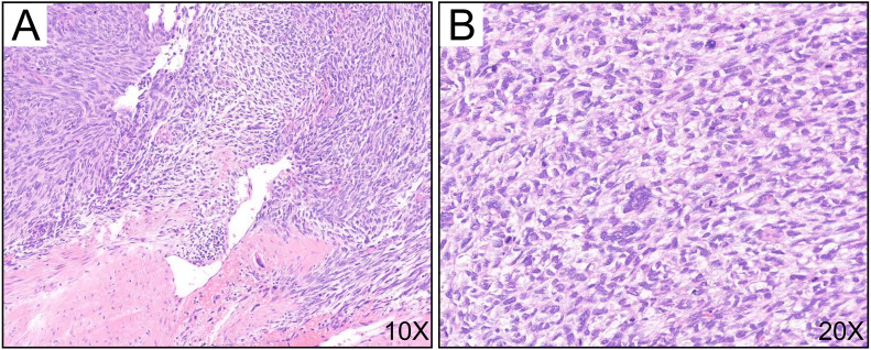 Figure 4
