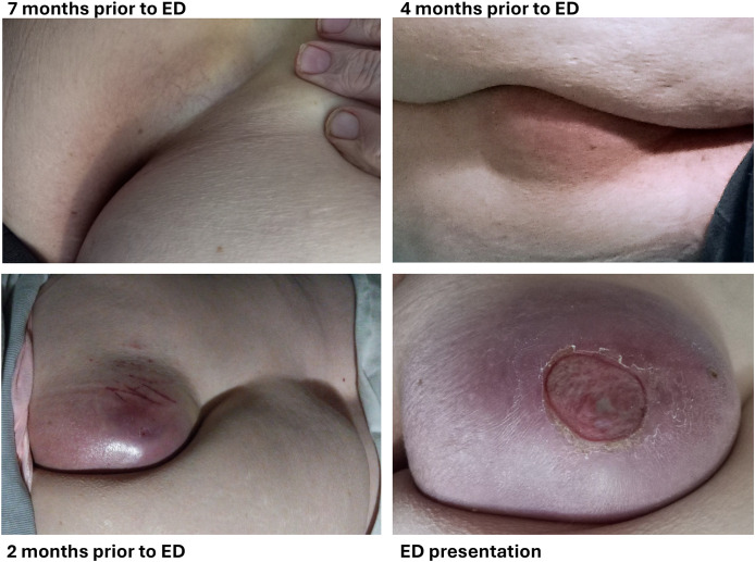 Figure 1