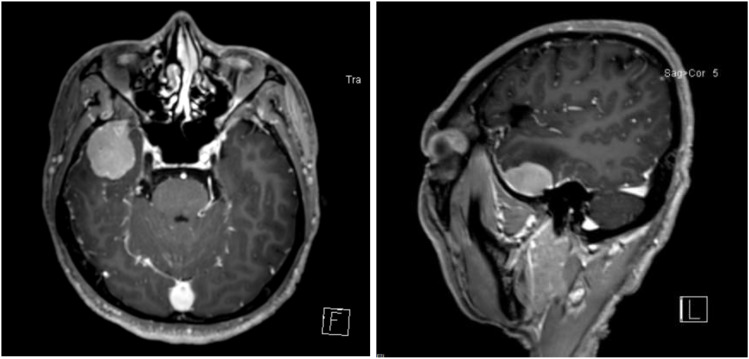 Figure 1