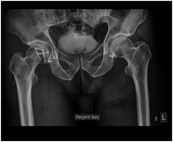Figure 3