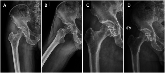 Figure 4