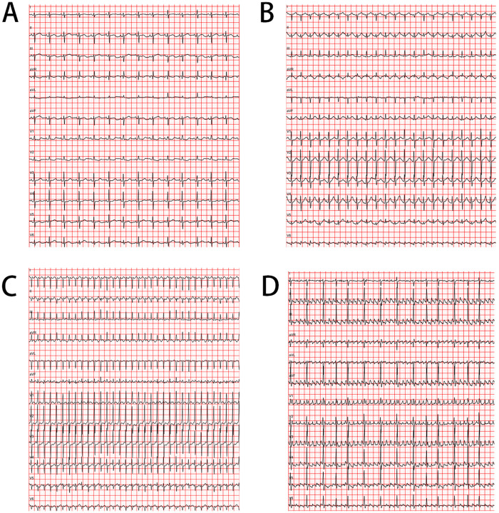 Figure 1