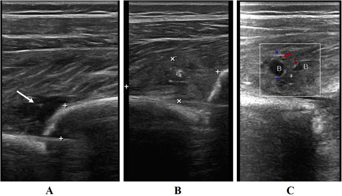 Figure 1
