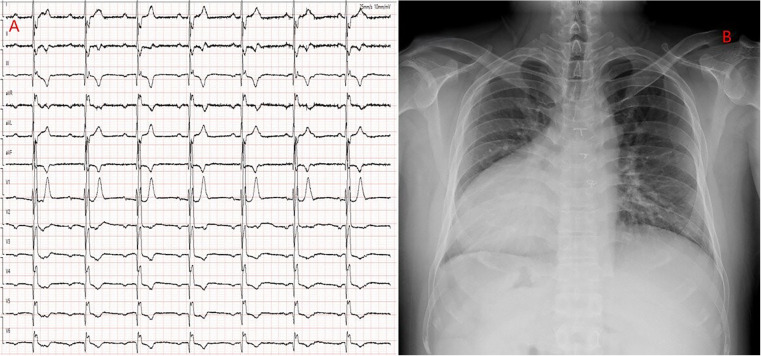 Figure 1