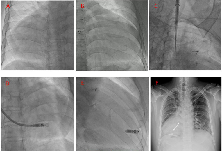 Figure 3