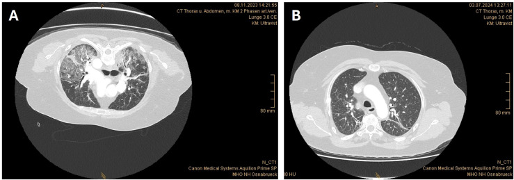 Figure 3