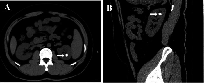 Figure 1
