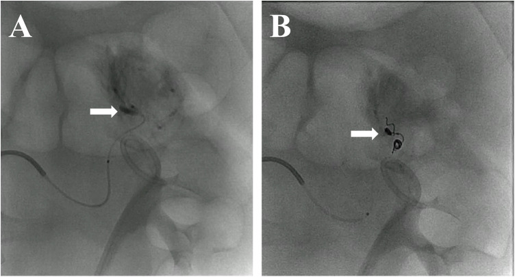 Figure 3
