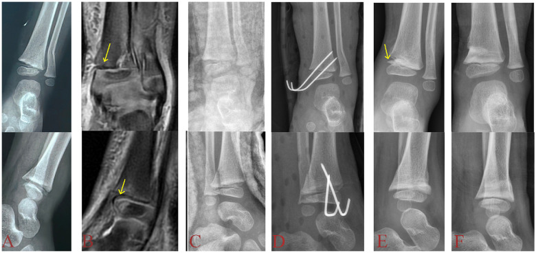 Figure 2
