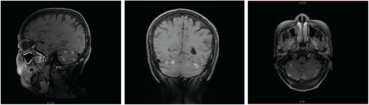 Figure 5