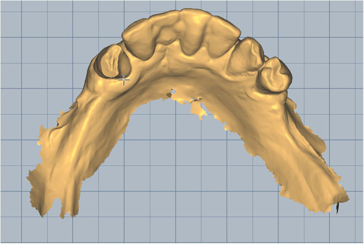 Figure 1