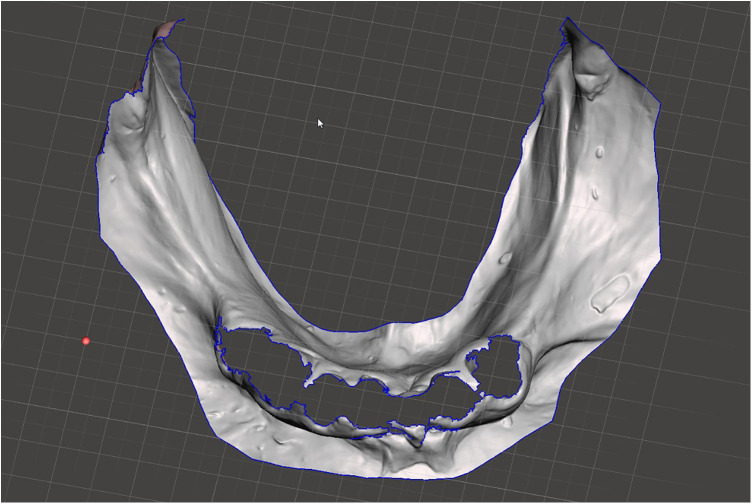 Figure 3