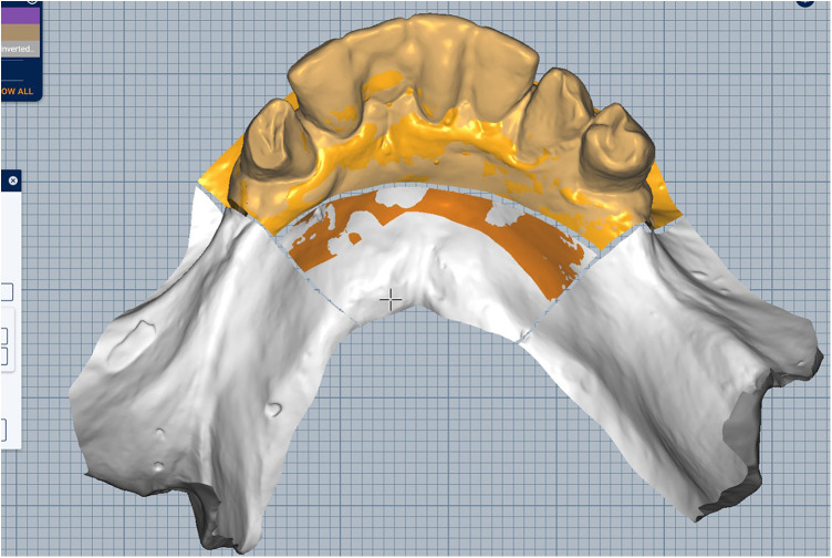 Figure 5
