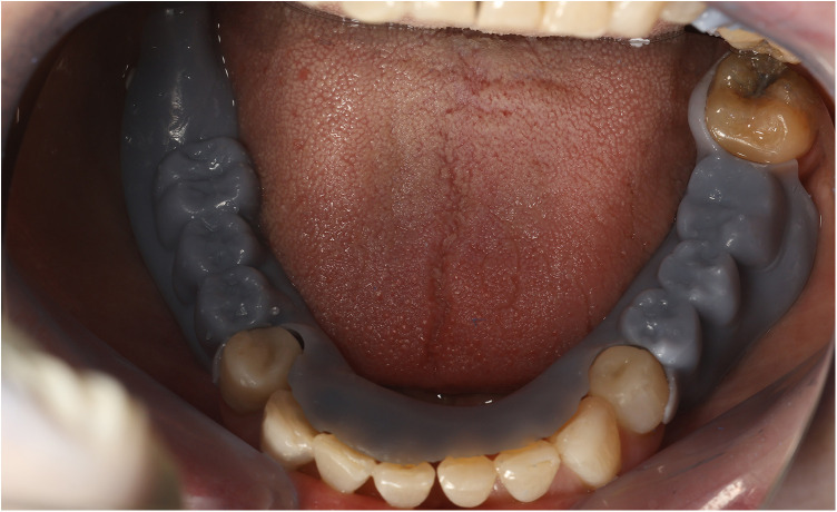 Figure 14