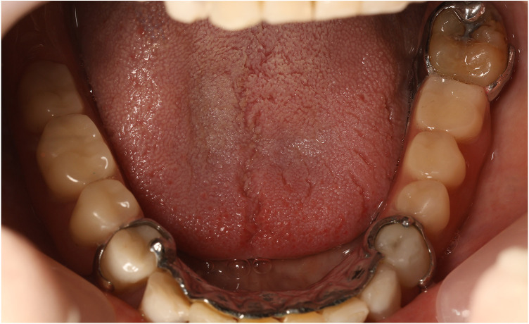 Figure 15