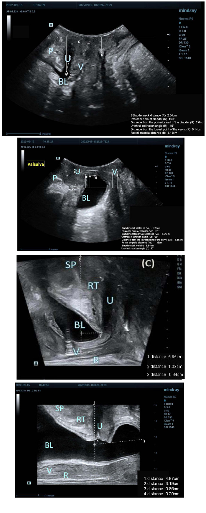 Figure 6