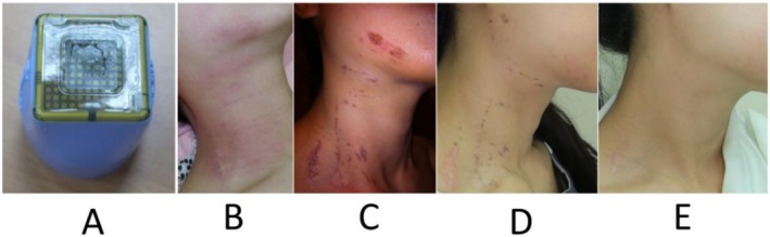 Figure 4