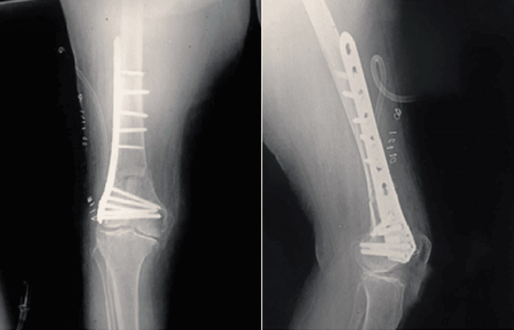 Figure 9