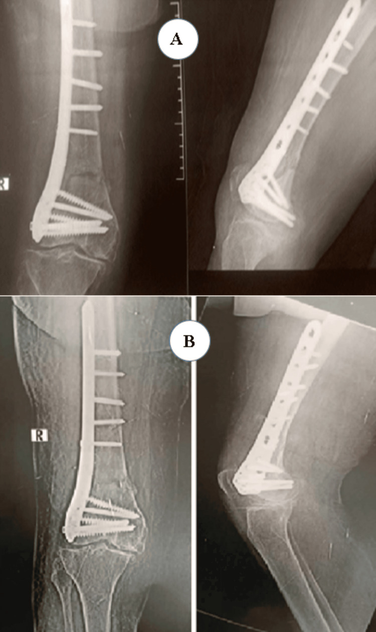 Figure 10
